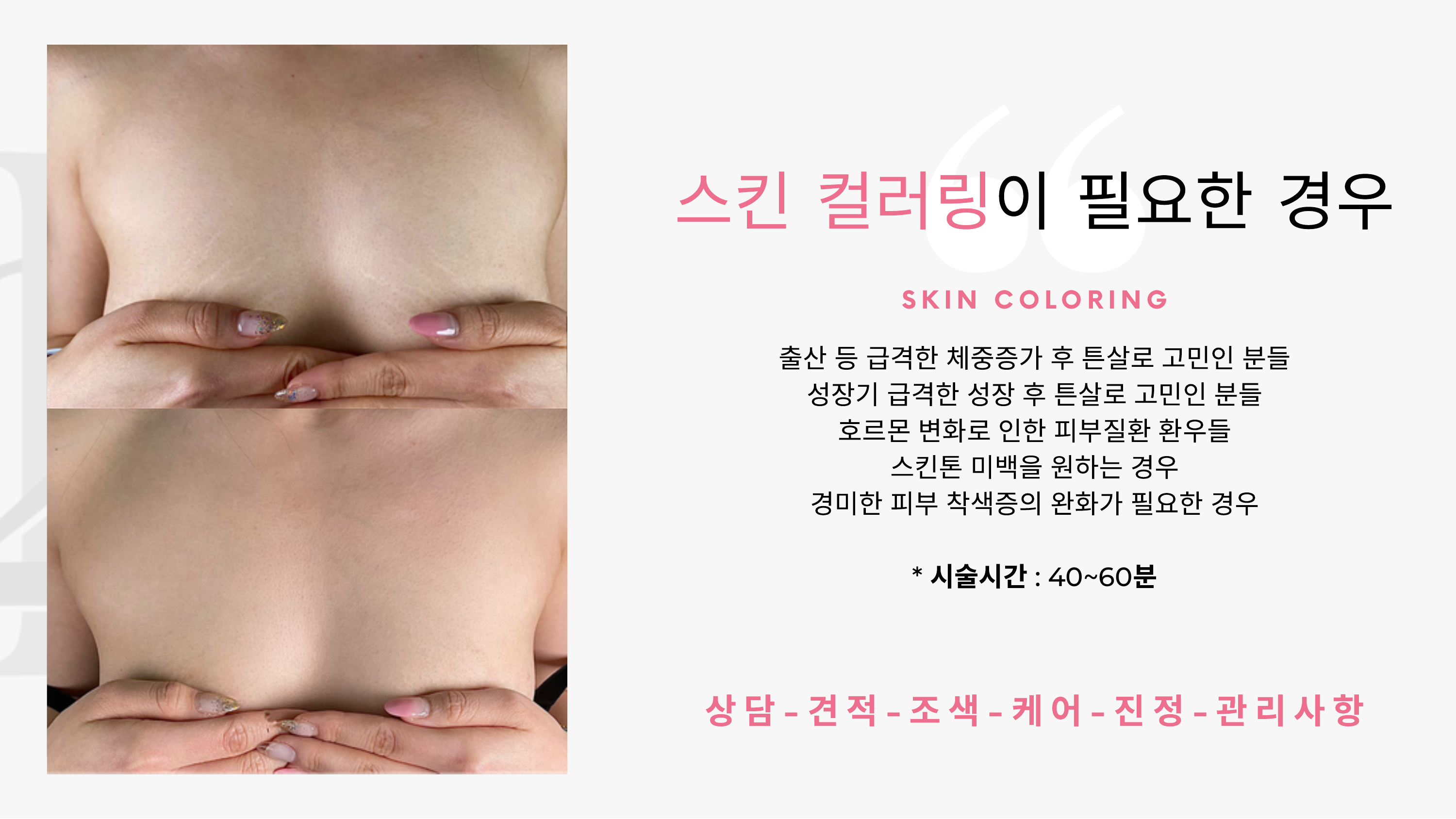 VOLUFILINE Clinical Data
